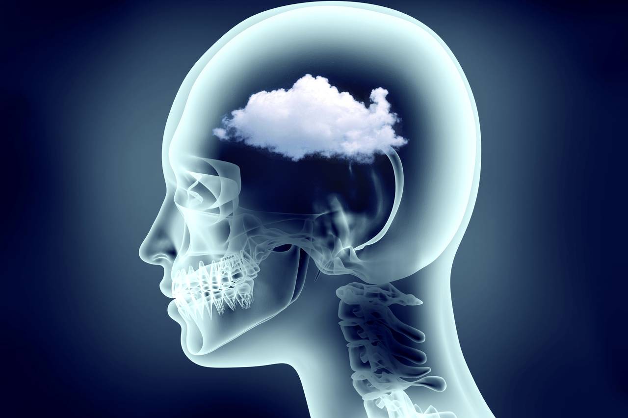 An image of a person's profile with transparent elements showing a cloud in their head and parts of their skeleton.