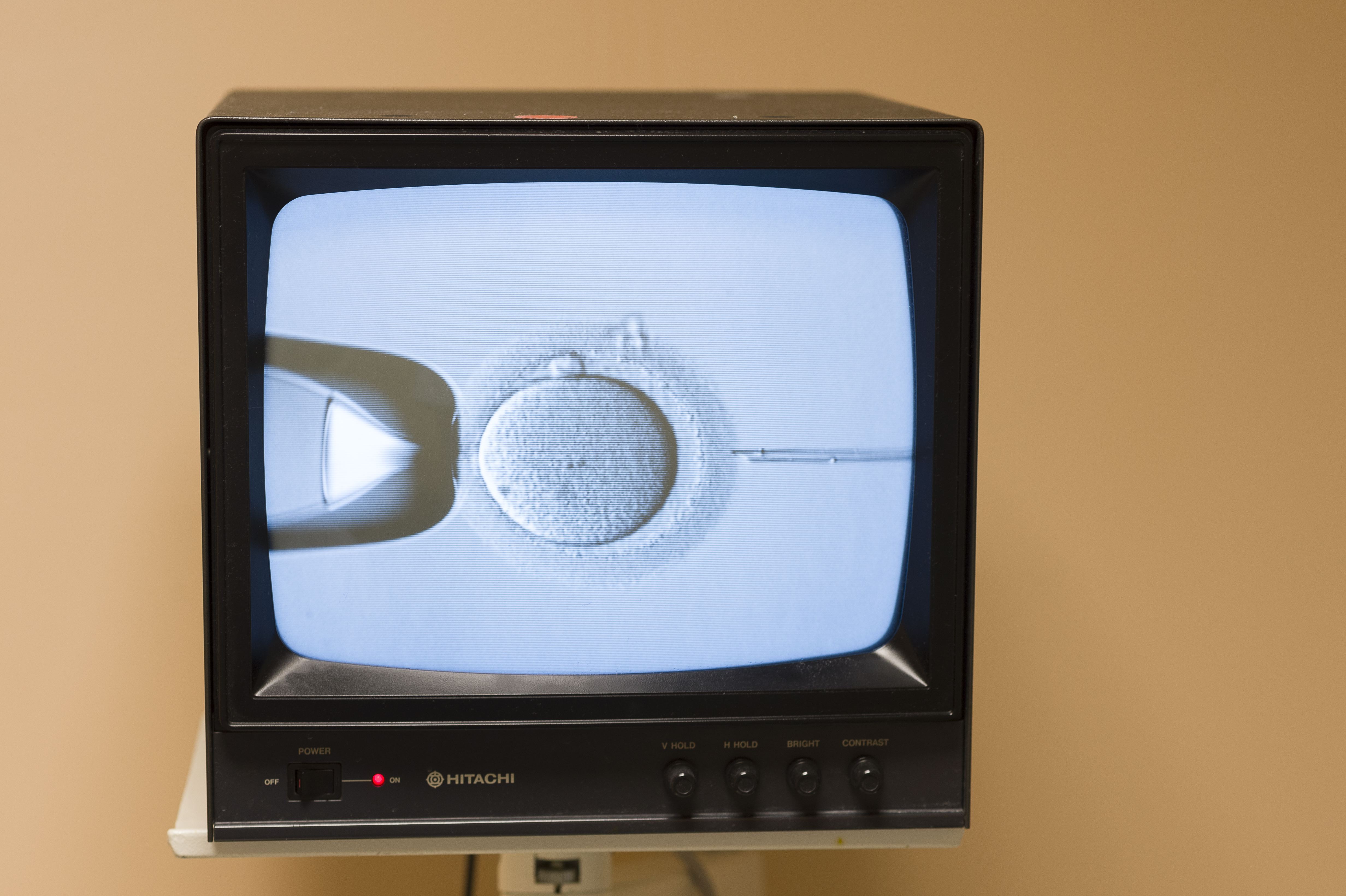 Manhattan fertility clinic faces multiple lawsuits over lost eggs