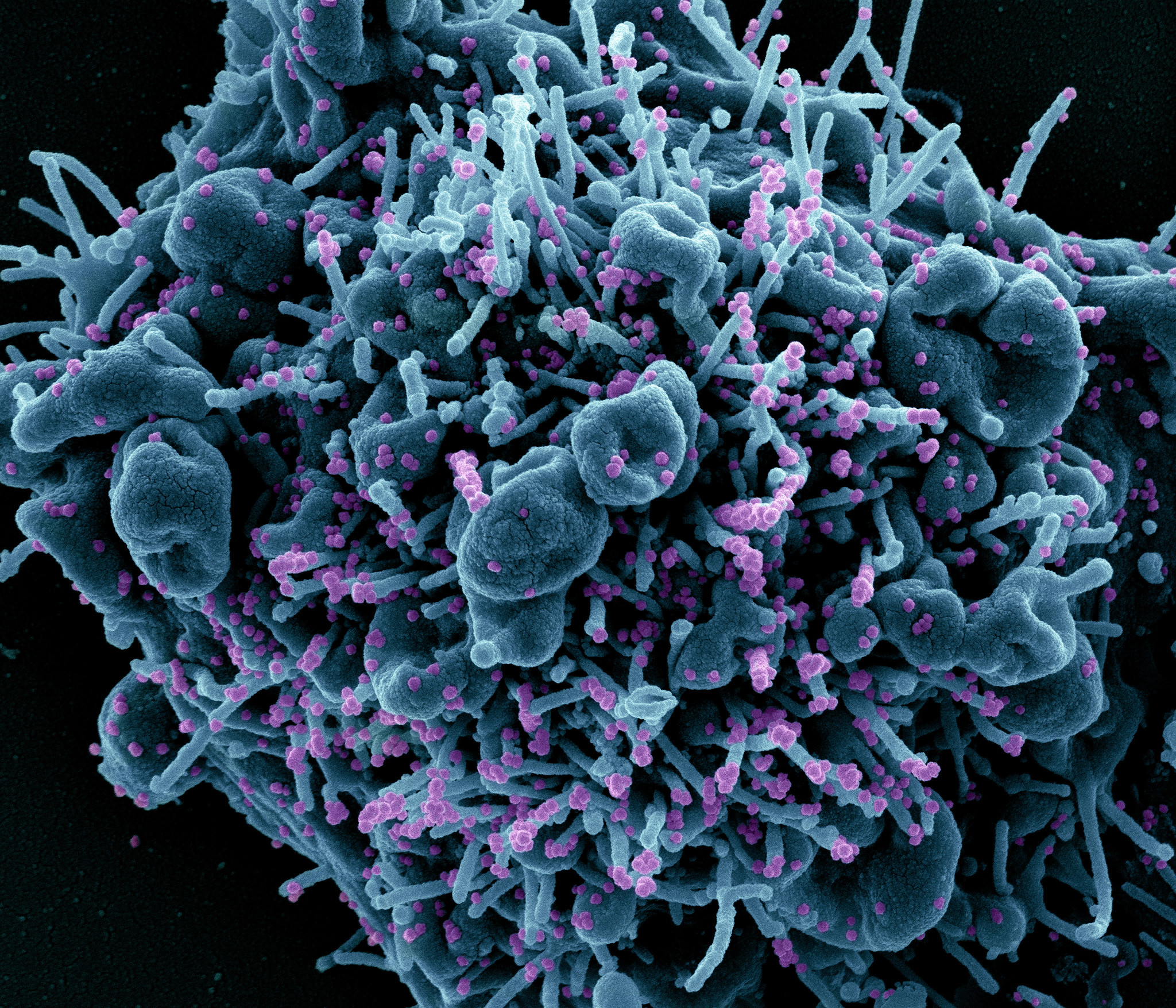 Coronavirus Statistics: Tracking The Epidemic In New York Coronavirus Statistics: Tracking The Epidemic In New York