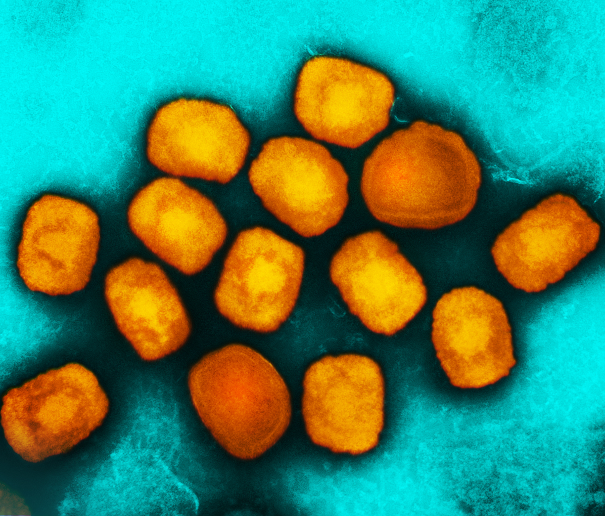 Monkeypox statistics: Tracking the outbreak in NYC and beyond