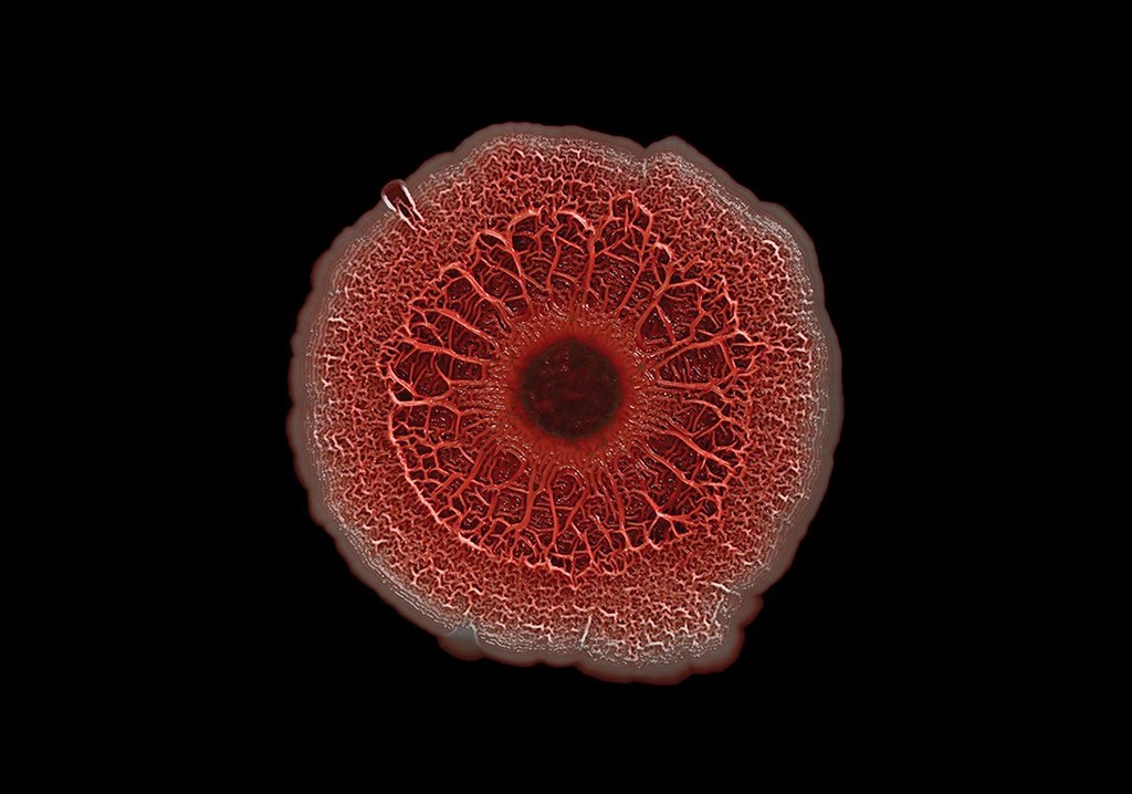 NY, NJ linked to outbreak of ‘extensively’ drug-resistant bacteria in eye drops NY, NJ linked to outbreak of ‘extensively’ drug-resistant bacteria in eye drops