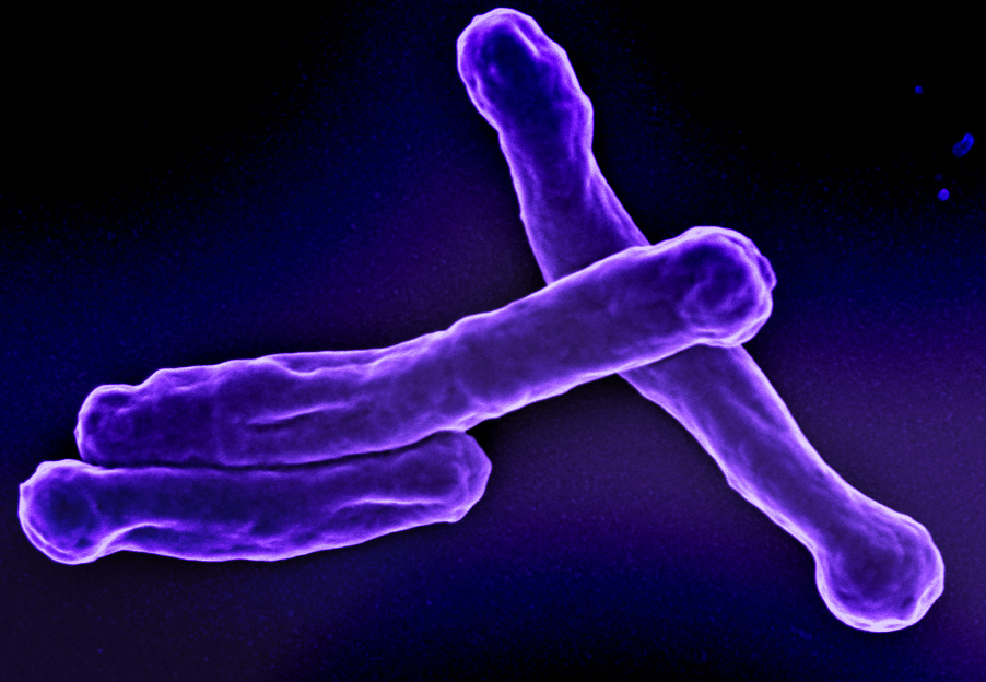 Tuberculosis rising after pandemic-era decline &mdash; NY caseload 40% higher than national rate